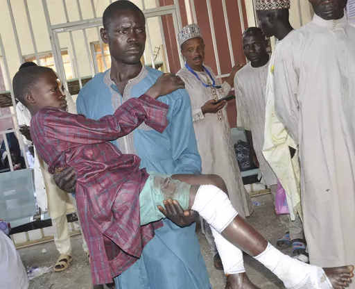 A victim of army drones attack receives treatment at a hospital in Kaduna Nigeria, Tuesday, Dec. 5, 2023. Nigeria's emergency services agency says more than 80 people are confirmed dead after military drones “mistakenly” bombed a religious gathering in the northwest. Some 60 people were injured in the attack Sunday in Kaduna state. (AP Photo/Olu Ajayi)