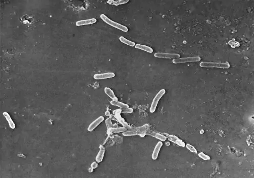 This scanning electron microscope image made available by the Centers for Disease Control and Prevention shows rod-shaped Pseudomonas aeruginosa bacteria. U.S. health officials are advising people to stop using the over-the-counter eye drops, EzriCare Artificial Tears, that have been linked to an outbreak of drug-resistant infections of Pseudomonas aeruginosa. The Centers for Disease Control and Prevention on Wednesday night, Feb. 1, 2023, sent a health alert to physicians, saying the outbreak i