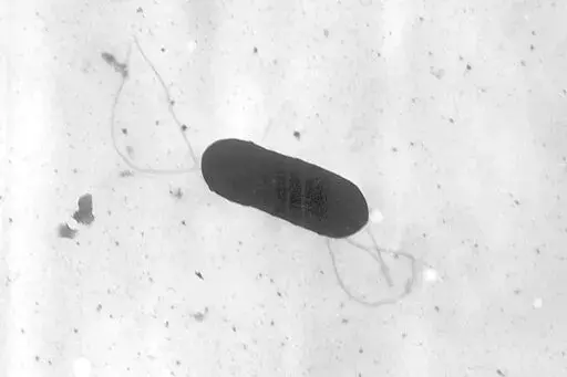 This 2002 electron microscope image made available by the Centers for Disease Control and Prevention shows a Listeria monocytogenes bacterium, responsible for the food borne illness listeriosis. On Wednesday, Nov. 9, 2022, U.S. health officials said at least one death and a pregnancy loss are tied to an outbreak of listeria food poisoning associated with sliced deli meats and cheeses that has sickened 16 people in six states, including 13 who were hospitalized. (Elizabeth White/CDC via AP, File)