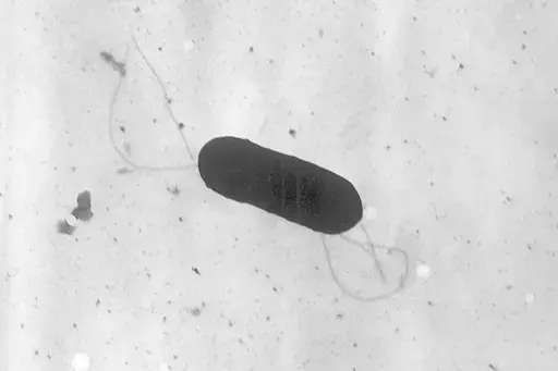 This 2002 electron microscope image made available by the Centers for Disease Control and Prevention shows a Listeria monocytogenes bacterium, responsible for the food borne illness listeriosis. (Elizabeth White/CDC via AP, File)