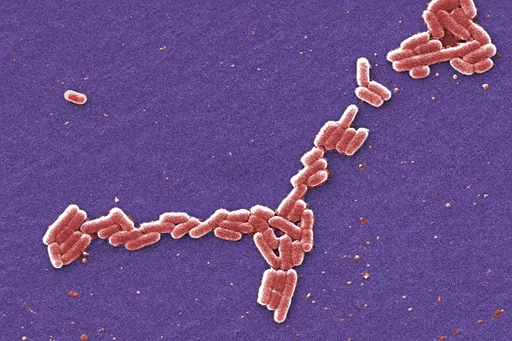 This colorized 2006 scanning electron microscope image made available by the Centers for Disease Control and Prevention shows E. coli bacteria of the O157:H7 strain that produces a powerful toxin which can cause illness. Health officials are investigating an outbreak of E. coli food poisoning among students at the University of Arkansas in late August 2023, with dozens reporting symptoms and several needing treatment in the hospital. (Janice Haney Carr/CDC via AP, File)