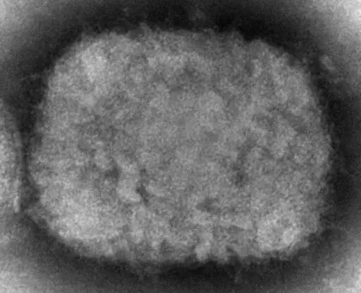 This 2003 electron microscope image made available by the Centers for Disease Control and Prevention shows a monkeypox virion, obtained from a sample associated with the 2003 prairie dog outbreak. The U.S. government is building up its supply of monkeypox vaccine to contend with escalating cases identified in a surprising international outbreak, health officials said Friday, June 10, 2022. (Cynthia S. Goldsmith, Russell Regner/CDC via AP, File)